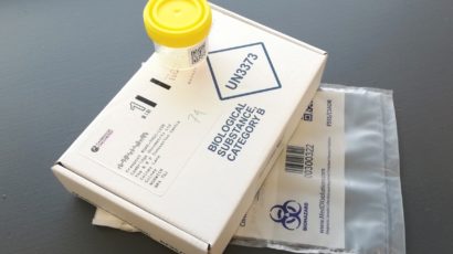 Non-invasive Molecular Test for those with Suspected Prostrate Cancer – Cambridge Oncometrix