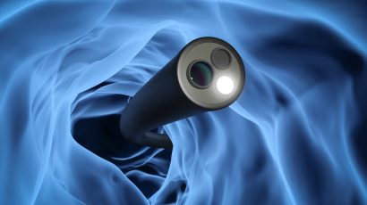 Robotic Device for Colonoscopy Procedures – Aker Health Tech