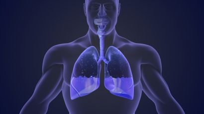 A Groundbreaking Solution to Avoid Delay in the Treatment of Pleural Effusion – Puddle Technology Ltd