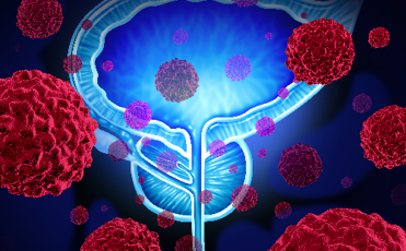 Cost Effectiveness Analysis on AI Tool to Support Diagnosis of Prostate Cancer – Lucida Medical